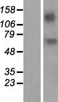 KCNN2 Human Over-expression Lysates NM_021614