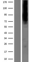 KCNN2 Human Over-expression Lysates NM_170775