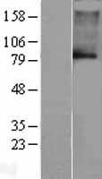 KCNN3 Human Over-expression Lysates NM_002249