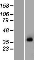 KCNN3 Human Over-expression Lysates NM_170782