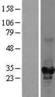ketohexokinase (KHK) Human Over-expression Lysates NM_000221