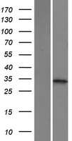 ketohexokinase (KHK) Human Over-expression Lysates NM_006488