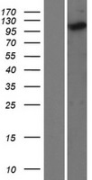 Kinesin 5C (KIF5C) Human Over-expression Lysates NM_004522