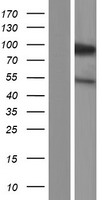KIFC3 Human Over-expression Lysates NM_001130100