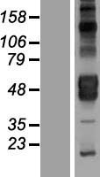 KIR2DL4 Human Over-expression Lysates NM_002255
