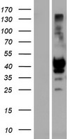 ls003806 kir2ds1 human over expression lysates nm 014512 wb testing 1