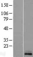 Kisspeptin (KISS1) Human Over-expression Lysates NM_002256