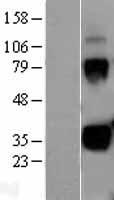 Kallikrein 1 (KLK1) Human Over-expression Lysates NM_002257
