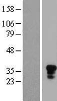 CD161 (KLRB1) Human Over-expression Lysates NM_002258