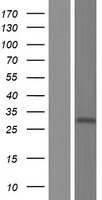 KLRC3 Human Over-expression Lysates NM_002261