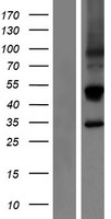 KLRC3 Human Over-expression Lysates NM_007333