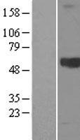 Kininogen 1 (KNG1) Human Over-expression Lysates NM_000893