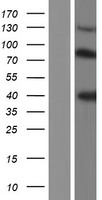 Kininogen 1 (KNG1) Human Over-expression Lysates NM_001166451