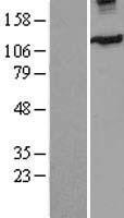 Eg5 (KIF11) Human Over-expression Lysates NM_004523