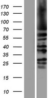 ls003833 kifc1 human over expression lysates nm 002263 wb testing 1
