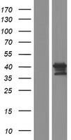 KIF25 Human Over-expression Lysates NM_030615