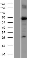 KIF22 Human Over-expression Lysates NM_007317
