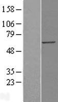 KPNA4 Human Over-expression Lysates NM_002268