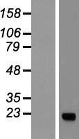 KRAS Human Over-expression Lysates NM_004985