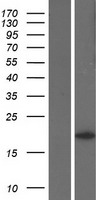 KRAS Human Over-expression Lysates NM_033360