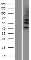 Cytokeratin 4 (KRT4) Human Over-expression Lysates NM_002272