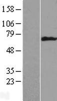 Cytokeratin 6B (KRT6B) Human Over-expression Lysates NM_005555