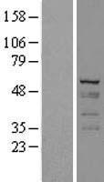 Cytokeratin 7 (KRT7) Human Over-expression Lysates NM_005556