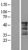 Cytokeratin 8 (KRT8) Human Over-expression Lysates NM_002273