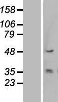 KRT13 Human Over-expression Lysates NM_153490