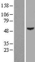 Cytokeratin 16 (KRT16) Human Over-expression Lysates NM_005557