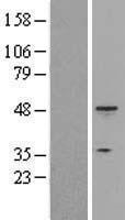 ls003875 cytokeratin 18 krt18 human over expression lysates nm 000224 wb testing 1