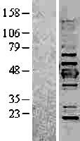 Cytokeratin 19 (KRT19) Human Over-expression Lysates NM_002276
