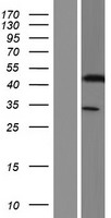 KRT33A Human Over-expression Lysates NM_004138