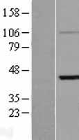 ls003884 krtha3b krt33b human over expression lysates nm 002279 wb testing 1