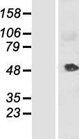 KRT34 Human Over-expression Lysates NM_021013