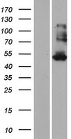KRT35 Human Over-expression Lysates NM_002280