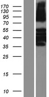 KRT81 Human Over-expression Lysates NM_002281