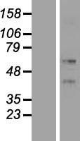 ls003892 krt86 human over expression lysates nm 002284 wb testing 1