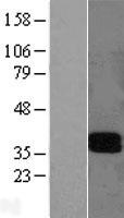LAIR1 Human Over-expression Lysates NM_002287