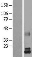 alpha Lactalbumin (LALBA) Human Over-expression Lysates NM_002289