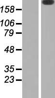 Laminin beta 2 (LAMB2) Human Over-expression Lysates NM_002292