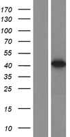 67kDa Laminin Receptor (RPSA) Human Over-expression Lysates NM_001012321