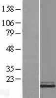 Stathmin 1 (STMN1) Human Over-expression Lysates NM_203399