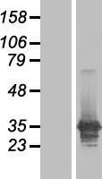 ls003927 lasp1 human over expression lysates nm 006148 wb testing 1