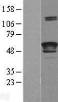 LCAT Human Over-expression Lysates NM_000229