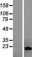 LCN1 Human Over-expression Lysates NM_002297