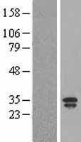 LCN2 Human Over-expression Lysates NM_005564