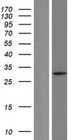 LDHA Human Over-expression Lysates NM_001135239