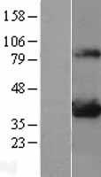 LDHA Human Over-expression Lysates NM_005566