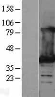 Lactate Dehydrogenase B (LDHB) Human Over-expression Lysates NM_002300